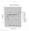 Fig. 03 - METHODS OF TREATING ABC-DLBCL USING INHIBITORS OF BRUTON'S TYROSINE KINASE