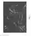Fig. 02 - Crystalline forms of a factor Xa inhibitor