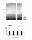 Fig. 02 - Micro-RNA associated with rheumatoid arthritis