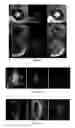 Fig. 03 - Application of highly conserved domain sequences from viral genome as template to design therapeutic slirnas