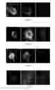 Fig. 04 - Application of highly conserved domain sequences from viral genome as template to design therapeutic slirnas
