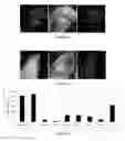 Fig. 05 - Application of highly conserved domain sequences from viral genome as template to design therapeutic slirnas