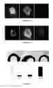 Fig. 09 - Application of highly conserved domain sequences from viral genome as template to design therapeutic slirnas