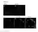 Fig. 03 - Methods For Identifying Compounds Effective To Increase The Expression Or Activity Of Aspartyl Aminopeptidase In Mammalian Pancreatic Islet Cells, And Methods For Decreasing Angiotensin II Levels In Mammalian Pancreatic Islet Cells