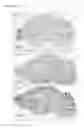 Fig. 04 - Methods For Identifying Compounds Effective To Increase The Expression Or Activity Of Aspartyl Aminopeptidase In Mammalian Pancreatic Islet Cells, And Methods For Decreasing Angiotensin II Levels In Mammalian Pancreatic Islet Cells