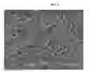 Fig. 02 - Bioabsorbable polymeric compositions, processing methods, and medical devices therefrom
