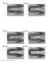 Fig. 05 - Bioabsorbable polymeric compositions, processing methods, and medical devices therefrom