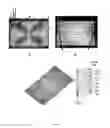Fig. 07 - Microporous Thermoplastic Article