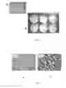 Fig. 09 - Microporous Thermoplastic Article