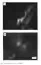 Fig. 15 - Microporous Thermoplastic Article
