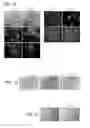 Fig. 02 - METHODS AND COMPOSITIONS FOR MODULATING TUMOR CELL ACTIVITY