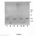 Fig. 02 - SELECTIVE ENRICHMENT OF ANTIBODIES