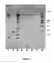Fig. 05 - SELECTIVE ENRICHMENT OF ANTIBODIES