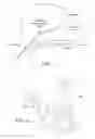 Fig. 09 - Correction of stress urinary incontinence