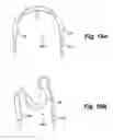 Fig. 11 - Heated balloon catheter