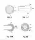 Fig. 13 - Heated balloon catheter