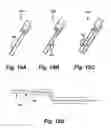 Fig. 16 - Heated balloon catheter