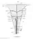 Fig. 32 - Heated balloon catheter