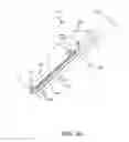 Fig. 33 - Heated balloon catheter