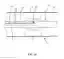 Fig. 34 - Heated balloon catheter