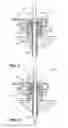 Fig. 05 - Biopsy inlet valve improvements