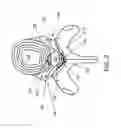 Fig. 03 - Cannulotome