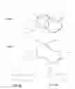 Fig. 10 - Cannulotome