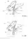Fig. 30 - Cannulotome