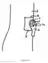 Fig. 04 - Dressing and method for cleaning and protecting a laparoscopic camera lens intra-abdominally, stomas, appendages, and insertion sites of tubes and catheters