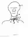Fig. 06 - Dressing and method for cleaning and protecting a laparoscopic camera lens intra-abdominally, stomas, appendages, and insertion sites of tubes and catheters