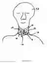 Fig. 07 - Dressing and method for cleaning and protecting a laparoscopic camera lens intra-abdominally, stomas, appendages, and insertion sites of tubes and catheters