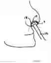Fig. 08 - Dressing and method for cleaning and protecting a laparoscopic camera lens intra-abdominally, stomas, appendages, and insertion sites of tubes and catheters