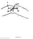 Fig. 13 - Dressing and method for cleaning and protecting a laparoscopic camera lens intra-abdominally, stomas, appendages, and insertion sites of tubes and catheters