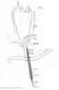Fig. 01 - Method for providing surgical access