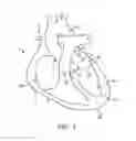 Fig. 02 - Method for providing surgical access