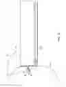 Fig. 104 - Method for providing surgical access