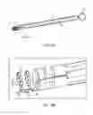 Fig. 13 - Method for providing surgical access