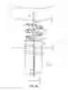 Fig. 14 - Method for providing surgical access
