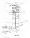 Fig. 15 - Method for providing surgical access
