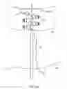 Fig. 18 - Method for providing surgical access