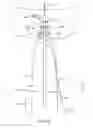 Fig. 23 - Method for providing surgical access