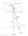 Fig. 25 - Method for providing surgical access