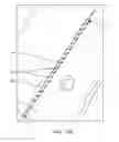 Fig. 41 - Method for providing surgical access