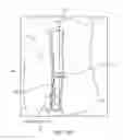 Fig. 45 - Method for providing surgical access