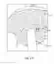 Fig. 51 - Method for providing surgical access