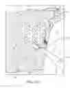 Fig. 52 - Method for providing surgical access