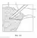 Fig. 54 - Method for providing surgical access