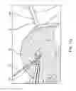 Fig. 55 - Method for providing surgical access