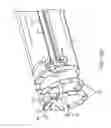 Fig. 62 - Method for providing surgical access