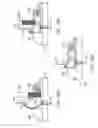 Fig. 85 - Method for providing surgical access